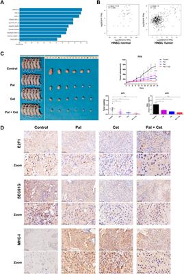 Increased response to TPF chemotherapy promotes immune escape in hypopharyngeal squamous cell carcinoma